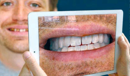 آینه مجازی لبخندتان را قبل از جراحی نشان می‌دهد