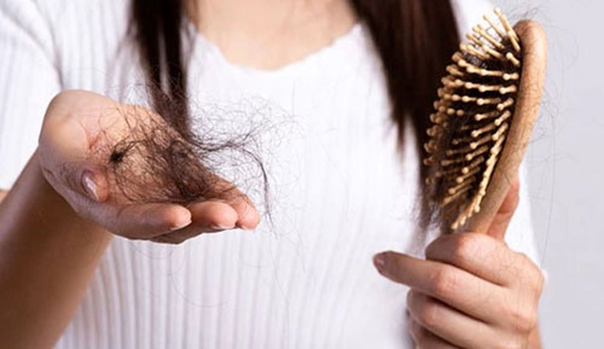 چرا موهای ما میریزد؟