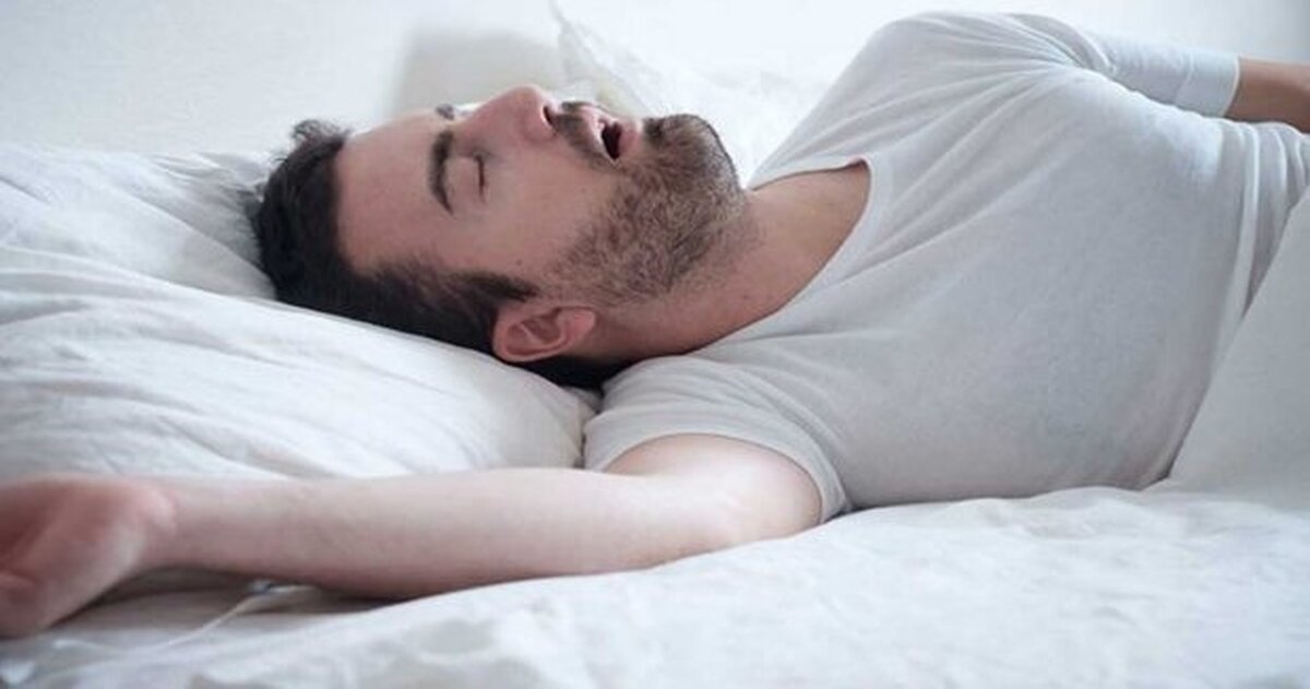 آپنه خواب این بلا را بر سر حافظه میآورد