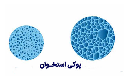 چه کسانی باید سنجش تراکم استخوان انجام دهند؟