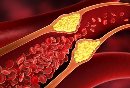 چند توصیه مهم درباره چربی خون