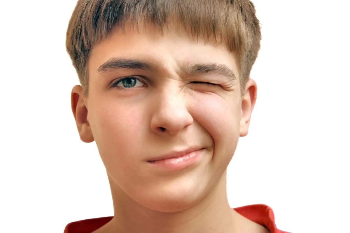 اختلال تیک چیست و چه چیزهایی آن را تشدید میکند؟