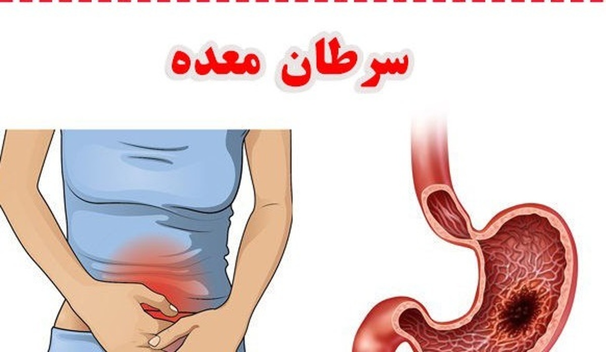 سرطانهای مرگباری که از بقیه سرطانها خطرناکتر هستند