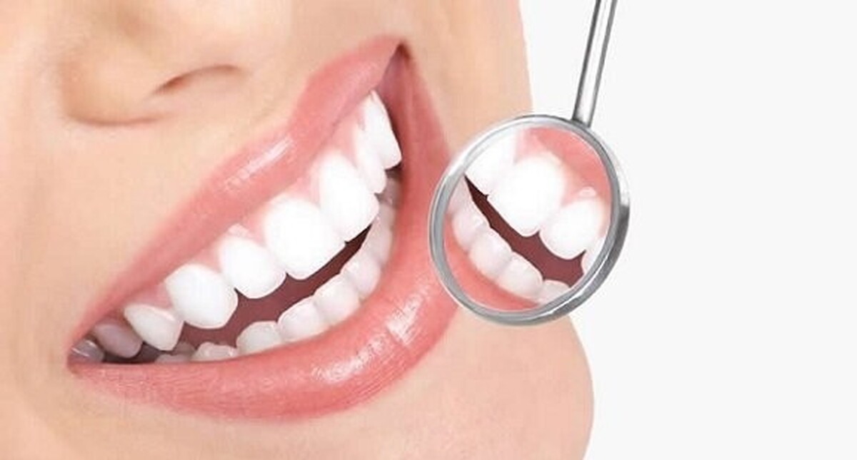 اگر میخواهید دندانی سفید و سالم داشته باشید این ماده غذایی را بخورید