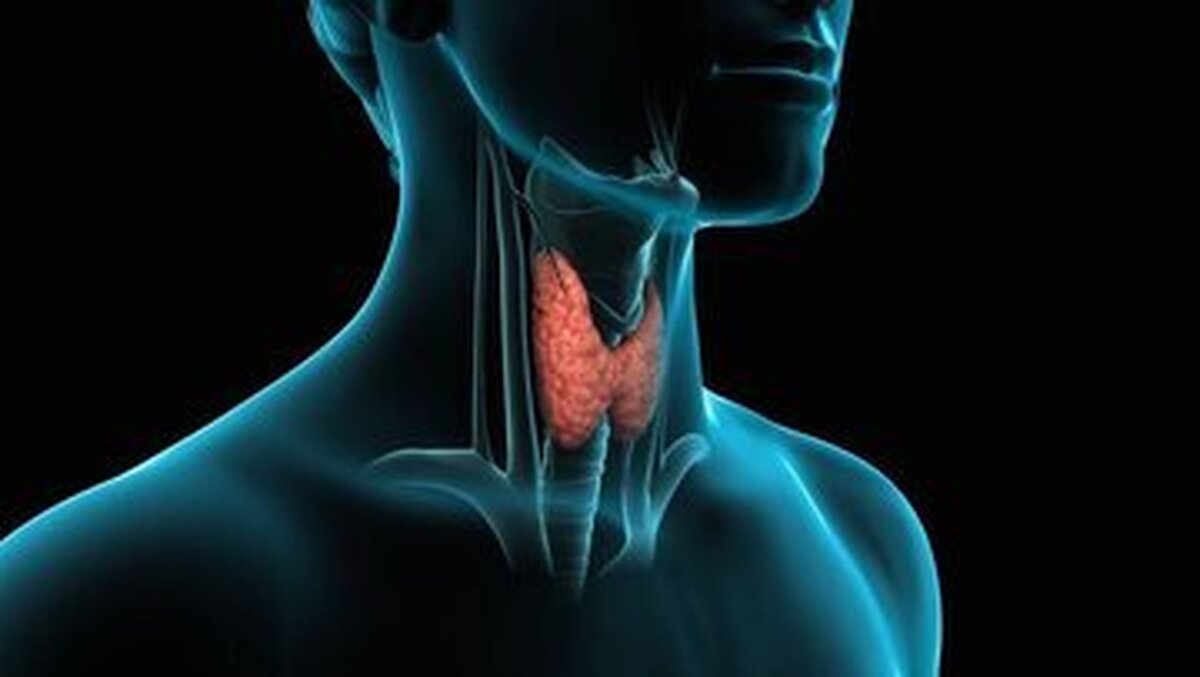 چگونه کمکاری تیروئید را رفع کنیم؟