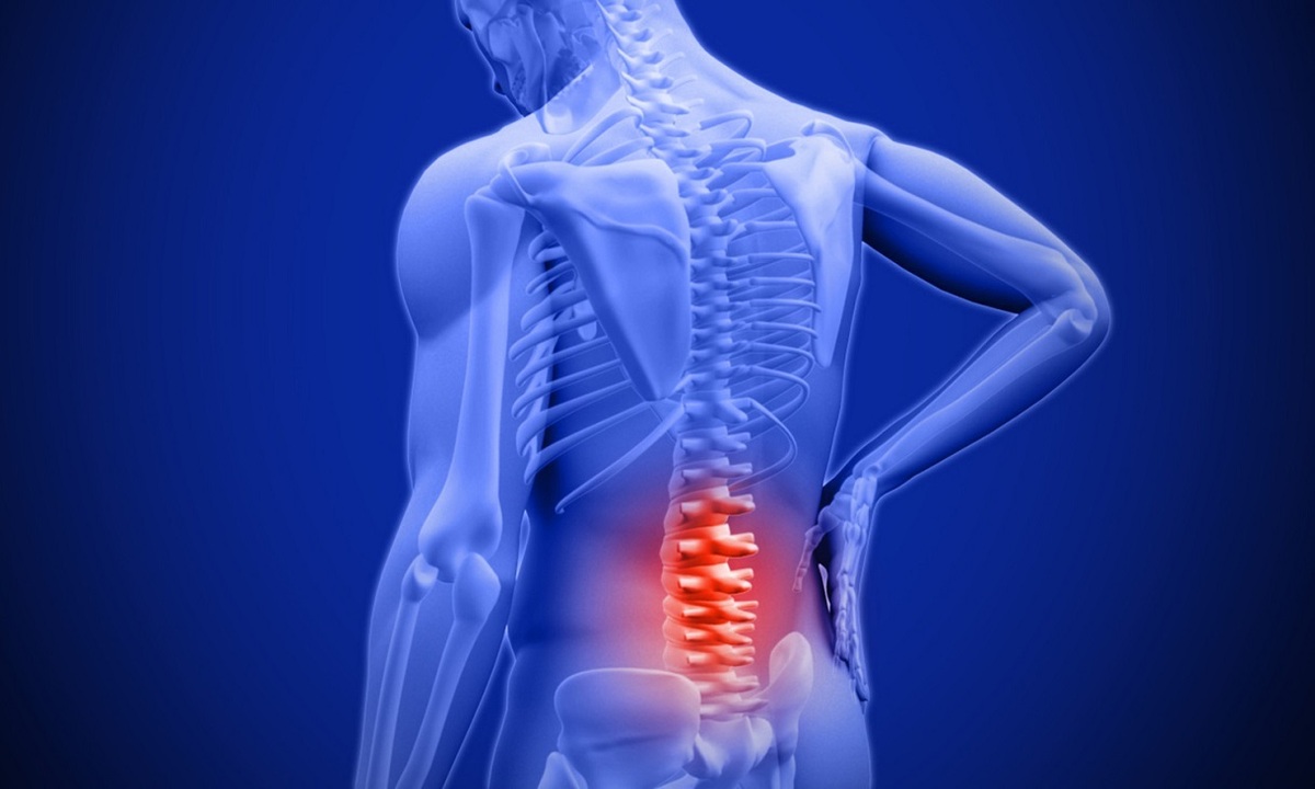 چگونه از کمردرد جلوگیری کنیم؟ چگونه از کمردرد جلوگیری کنیم؟