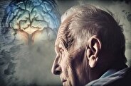 با نشانه های پیری زودرس آشنا شوید!