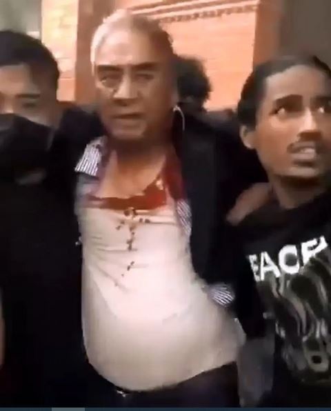 «شِر بهادر دئوبا» نخست‌ وزیر پیشین نپال به‌ همراه همسرش از منزل مسکونی‌شان بیرون کشیده شده و مورد ضرب‌وشتم قرار گرفتند + فیلم