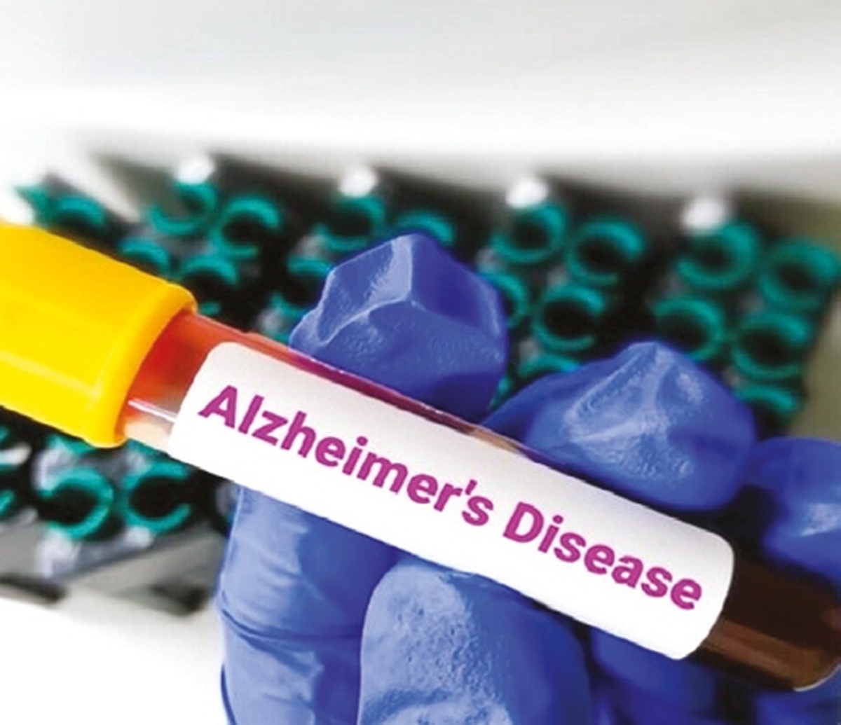 تاثیر پیاده‌روی روزانه بر مهار آلزایمر