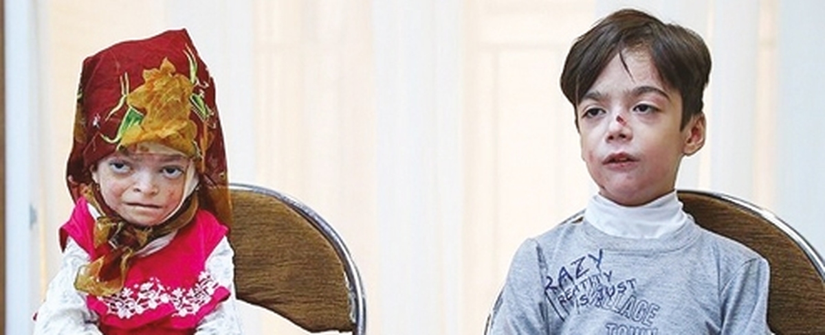 تخمين وجود 3 ميليون بيمار نادر در كشور