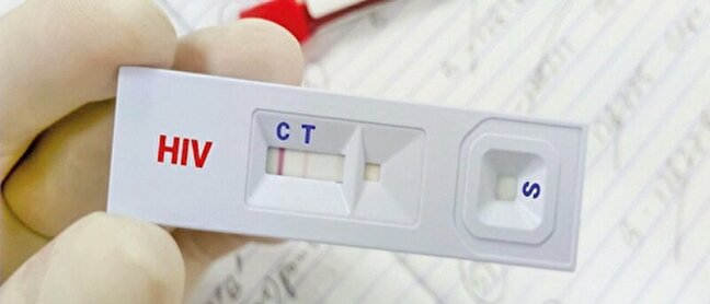 ترس، انگ و خاموشي  دليل عمده ناشناس ماندن بيماران مبتلا به ايدز