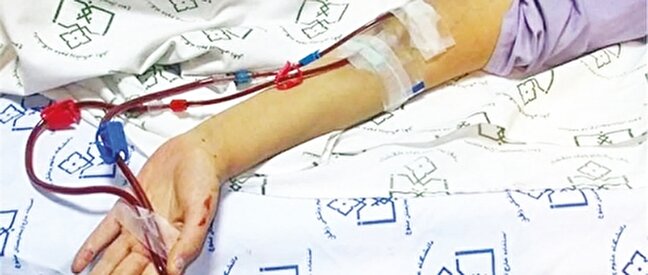 توقف توزيع داروي «مايفورتيك»؛ برخي بيماران پيوندي در معرض خطر رد عضو