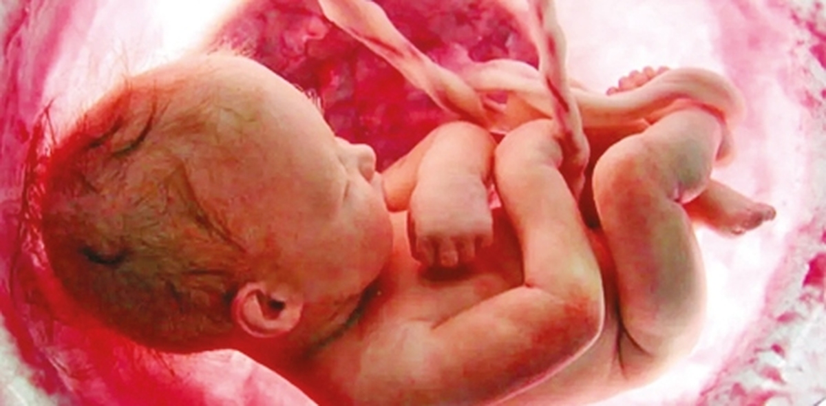 آلودگي هوا ؛ تهديد خاموش